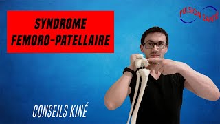 Soigner efficacement le syndrome fémoro patellaire  Conseil KINE et autoexercices [upl. by Obeded]