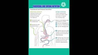 Parenteral nutrition and Enteral nutrition nursingnotes [upl. by Macpherson]