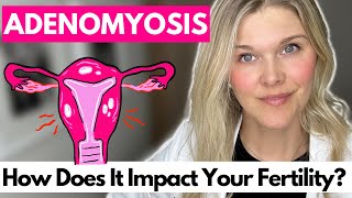 Adenomyosis What are the Symptoms Treatment and Diagnosis How Does It Impact Your Fertility [upl. by Iruyas]