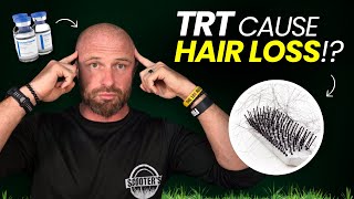 Can TRT Make You Lose Hair Faster Heres What You Should Know [upl. by Dorej]