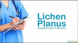 Lichen Planus Symptoms and Treatment [upl. by Sokairyk118]