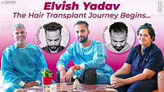 Unlocking Celebrity Hair Transplant Secrets Elvish Yadavs Eugenix Experience [upl. by Guenevere]