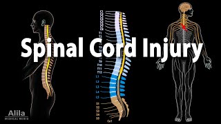 Spinal Cord Injury Animation [upl. by Fritzsche]