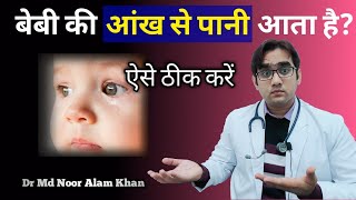 बच्चे की आंख से पानी आना  Watery eyes in babies  cause and treatment Dr Md Noor Alam Khan [upl. by Kempe]