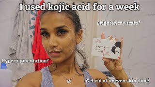 I Used Kojic Acid For A Week amp This Happened  Kojie San Review [upl. by Maximilian795]