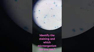 drpreetimicro znstaining mycobacteria microbiology neet medical tuberculosis laboratory [upl. by Eniawed]