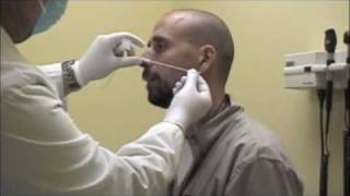 Procedure for Nasopharyngeal Swabs and Aspirates [upl. by Porter90]