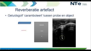 Webinar  Beeldfouten en artefacten in de echografie [upl. by Aidroc]