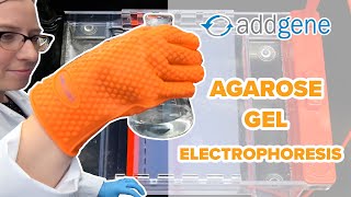 Agarose Gel Electrophoresis [upl. by Gona]