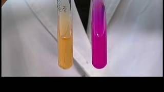 Urease and gelatinase test [upl. by Horace]