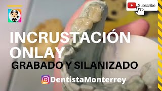 INCRUSTACIÓN DENTAL Porcelana Onlay 👅Grabado y Silanizado [upl. by Cheung]