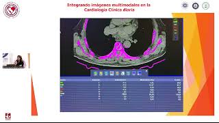 Reunión Científica Mensual Integrando Imágenes multimodales en la Cardiología diaria [upl. by Casady271]