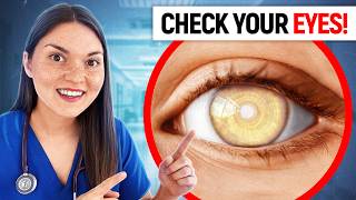 What Your EYES Say About your HEALTH Doctor Explains [upl. by Adnaloj]