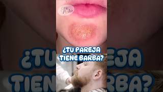 Cuida tu BARBA o causarás ESTO ✌🏻 más en IG medicina sabiasque curiosidades [upl. by Lea]