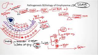 COPD Emphysema pathogenesis and etiology [upl. by Eirual]