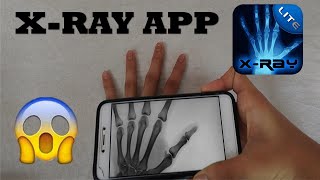 XRay App [upl. by Annaerb351]