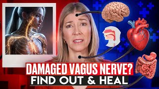 Is My Vagus Nerve Damaged Find Out Now [upl. by Airat]