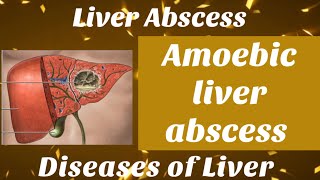 Amoebic liver abscess  in Hindi with notes  liver abscess surgery bamsfinalyear shalyatantra [upl. by Ahsimat]