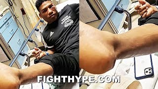 GAMBOA SETS RECORD STRAIGHT ON FIGHTING GERVONTA DAVIS WITH quotSNAPPEDquot TENDON quotI REFUSED TO QUITquot [upl. by Yeslaehc836]