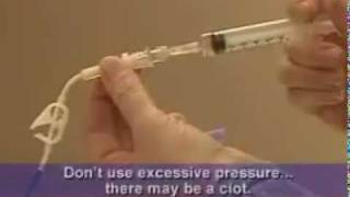 Broviac Catheter Care Videos Flush the Catheter [upl. by Einhapets837]