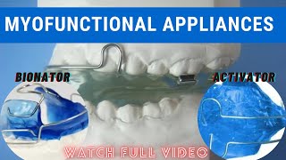 MYOFUNCTIONAL APPLIANCES  ACTIVATOR  BIONATOR myofunctionalappliances orthodontics [upl. by Nonnahs]