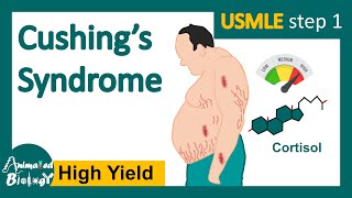 Cushings syndrome  How is Cushing syndrome diagnosed  Treatment of Cushings syndrome  USMLE [upl. by Oeht]