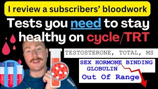 Blood test for low testosterone  I review a subscribers bloodwork HIGH SHBG LOW T [upl. by Behre]