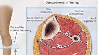 What is Compartment Syndrome  TheNurseNinja [upl. by Nomit]