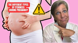 Itching During Pregnancy [upl. by Jane]