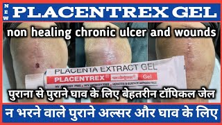 प्लेसेंट्रेक्स जेल कौन सा घाव ठीक करने में काम आता है  PLACENTREX GEL [upl. by Elroy]