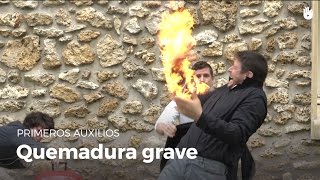 Aprende gestos de primeros auxilios  Quemadura grave [upl. by Ecirahc]