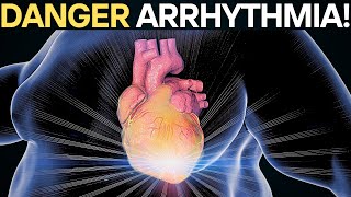 CARDIAC arrhythmia and its symptoms [upl. by Nek801]