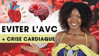 COMMENT EVITER l AVC🧠 amp la CRISE CARDIAQUE🫀 en 2024  3 examens simples pour PREVENIR L AVC [upl. by Erich140]