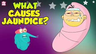 Jaundice  Causes of Jaundice  The Dr Binocs Show  Peekaboo Kidz [upl. by Eonak120]