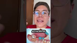 👀 diente humor dientesblancos shortsviral comedia dientes shortvideos memes viralvideos [upl. by Kask]