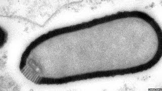 Virus Resurrected After Being Frozen For 30000 Yrs  Pithovirus Sibericum [upl. by Yoong213]