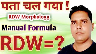 RDW blood test hindi  RDW manual formul  RDW morphology [upl. by Benson370]