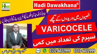 Varicocele ka ilaj in urdu  Varicocele kya hai  Varicocele natural treatment without surgery [upl. by Feld]