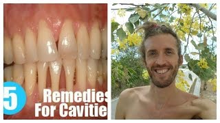 How To Heal Cavities Strengthen And Remineralize Teeth amp Bones Ligaments Joints Flesh amp Tendons [upl. by Sakhuja336]