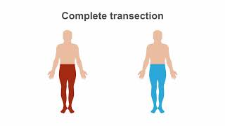 Spinal Cord Syndromes Clinical Recognition amp Anatomy Review [upl. by Sedlik]