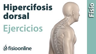 Ejercicio para eliminar por completo la hipercifosis dorsal [upl. by Ykcul]