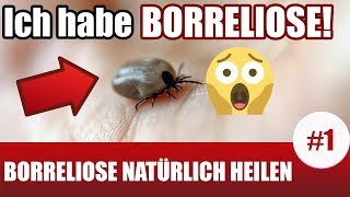 Ich habe Borreliose Borreliose Behandlung natürlich 1 [upl. by Alliehs135]