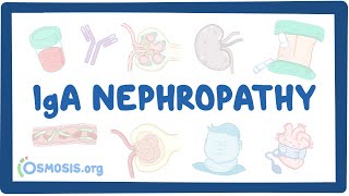 IgA nephropathy  causes symptoms diagnosis treatment pathology [upl. by Fillender]