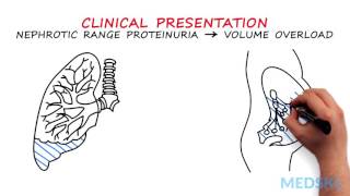 Nephrology – Proteinuria By Manish Suneja MD [upl. by Edmee]