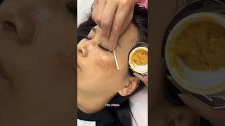 Remove Dark Spots amp Pigmentation Naturally At Home  Get Glowing Skin skin beautiful shorts [upl. by Idurt890]