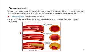 Cours dEndocrinologie vidéo 9  Pathologie de léquilibre glycémique [upl. by Schrader206]