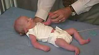 neurology exam newbornabnormal Primitive Reflexes  Moro [upl. by Lemrahc]