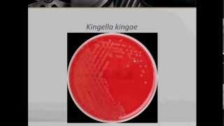 Bacteriology Gram Negative Coccobacilli Part 1 [upl. by Ennaus]