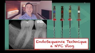 EndoSequence Molar Technique in NYC Vlog [upl. by Paff778]