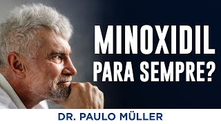 Minoxidil tem que usar para sempre – Dr Paulo Müller Dermatologista [upl. by Yeknarf]